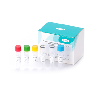 Kit de teste de ácido nucleico de micoplasma pneumoniae (método de fluorescência PCR)